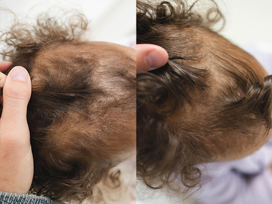 Mommy & Me Crown Care System