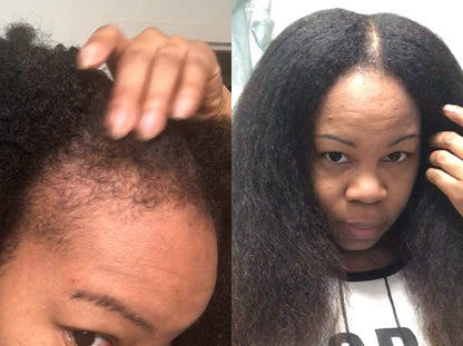 A. S. H. Queen Crown Restoration System